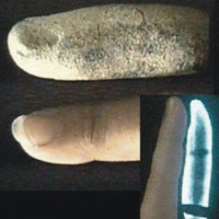 Окаменевший палец человека, бывшего современником динозавров <br>Фото с сайта www.anomal-zona.webzone.ru